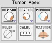 ImageControlsTumorApex