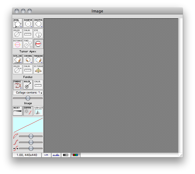 ImageWindowFundusStartup