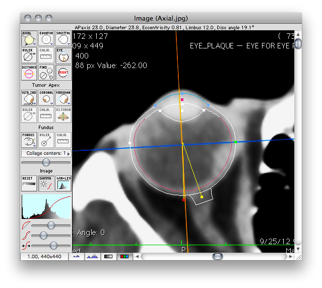 Image window