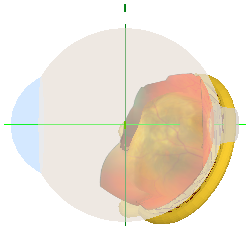Medial