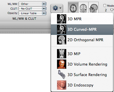 OsiriX2D3Dmenu.png