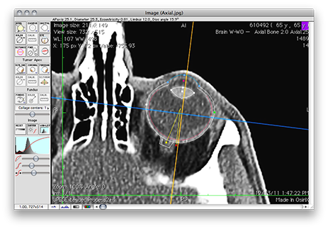 CalibrateCTEyeTool