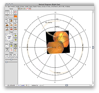 DiagramWithPhotoAndBackground