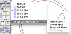 DoseCoronalPopUpMenus