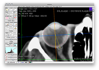 EyeToolAxial