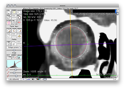 EyeToolEquatorial