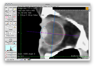EyeToolSagittal