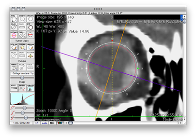 EyeToolTCor