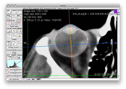 EyeToolTMer
