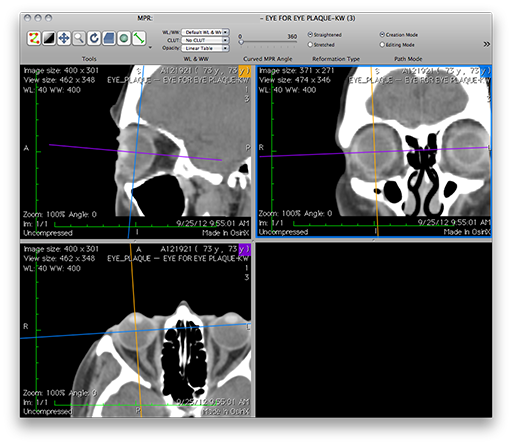 OsiriX4Pane.png
