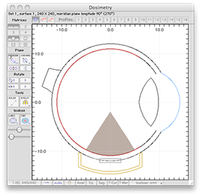 QA2012Dosimetry