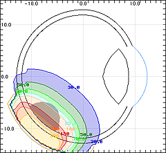 DosimetryMeridian