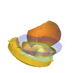 SetupRet3DDose