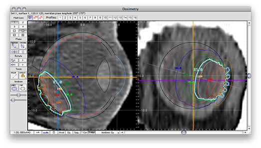 IT45PlanarDosimetry