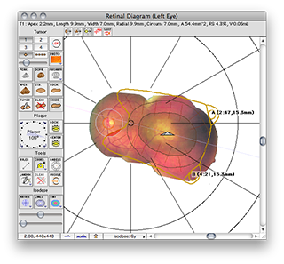ITEP917Centered