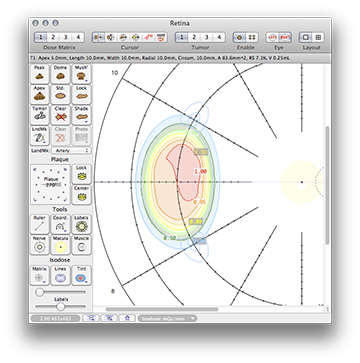 CCZ90RetinaDose