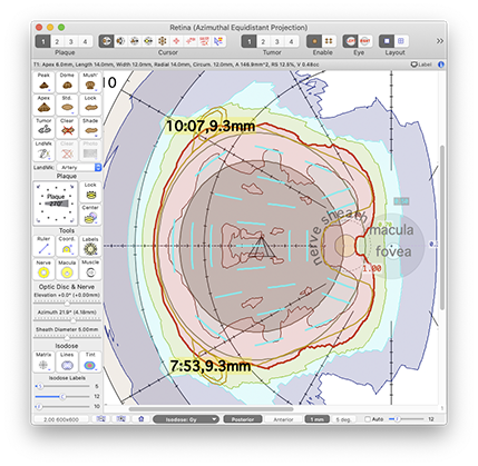 EP1824_Retina