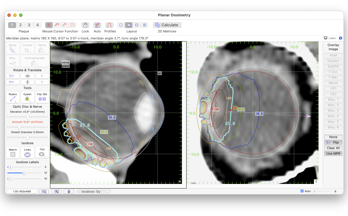 Dosimetry window