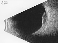 ultrasound