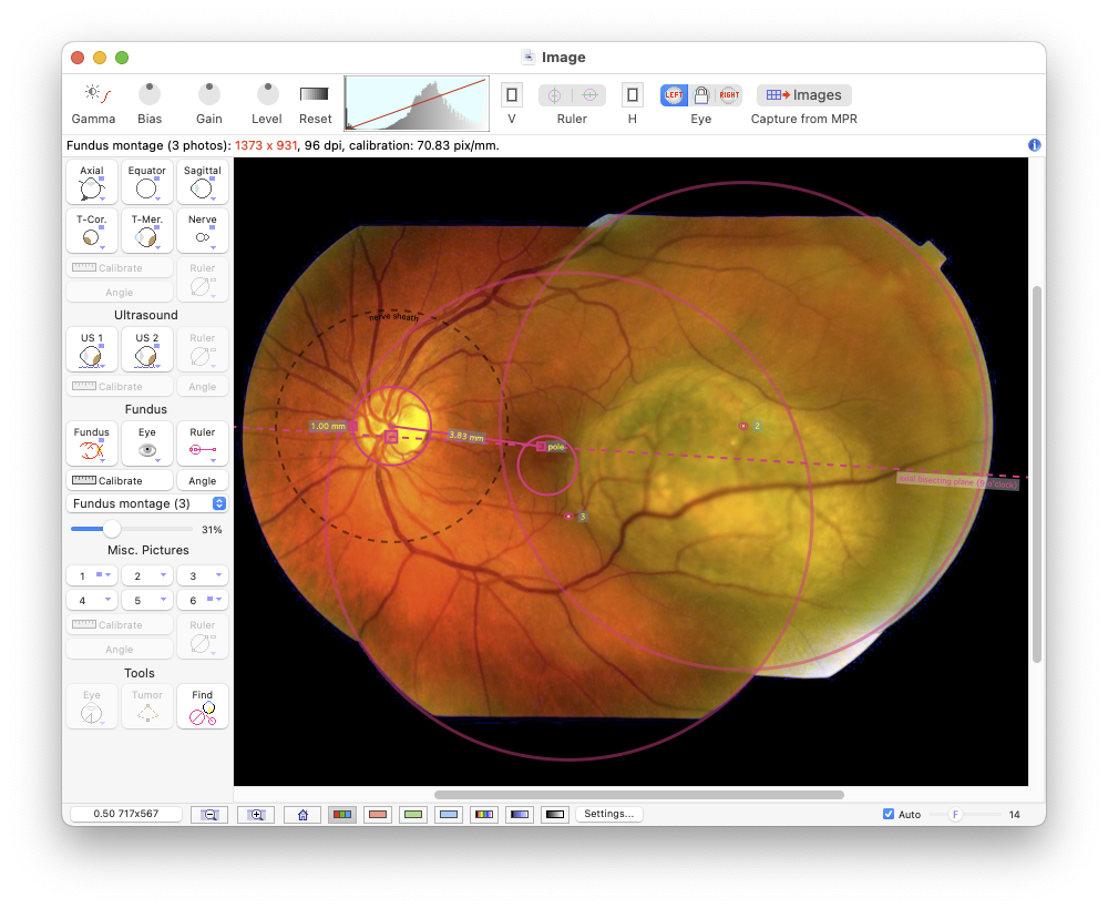 Image window with fundus