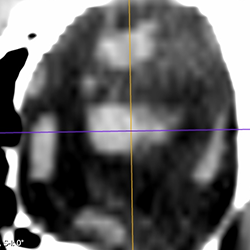 NervePlaneImage