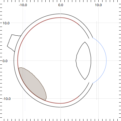 TumorApexCenteredMeridian