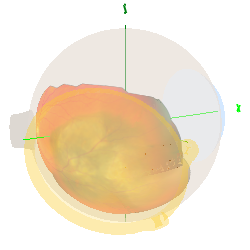 TumorApexView
