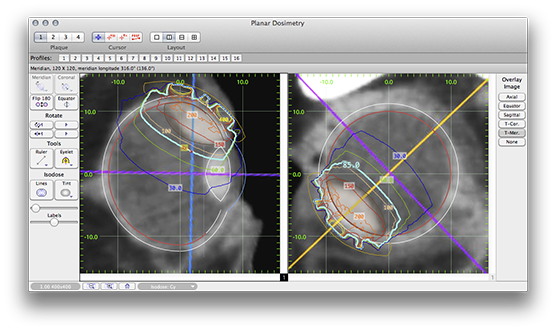 AT7PlanarDosimetry