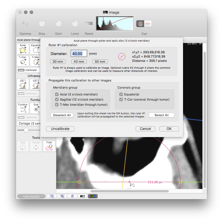 CalibrateAllCTImages
