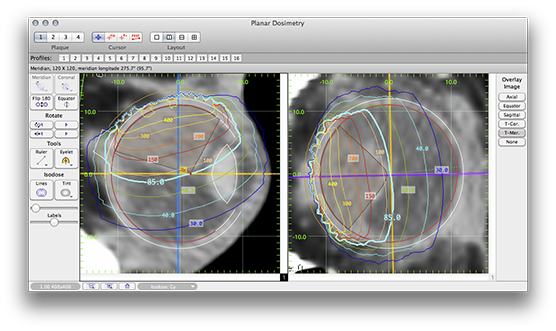 LT2038PlanarDosimetry