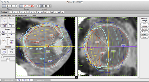 PlanarDosimetryWithShell
