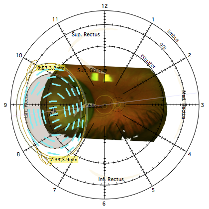 DiagramLoaded