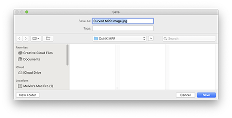 OsirixExport1