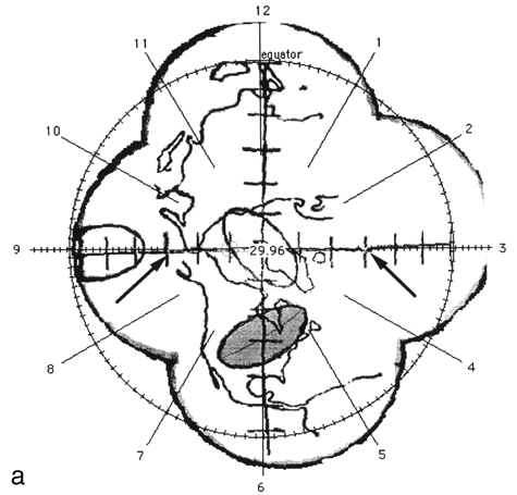 Figure 2a